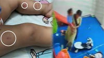 Toddler Brutally Assaulted at Daycare, Attendant and Owner Booked